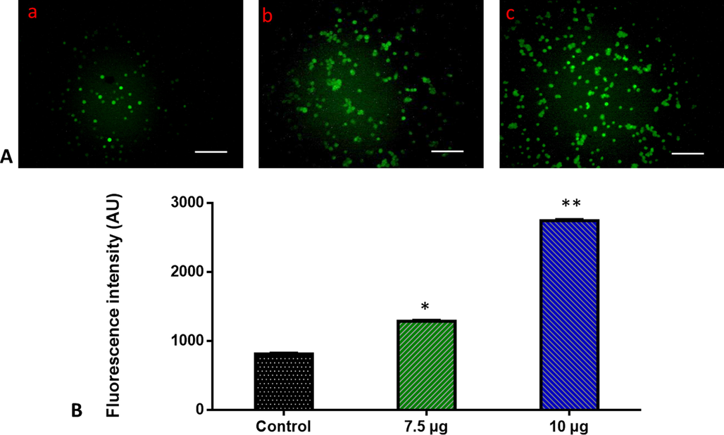 Effect of ZnO-TiO2-Chitosan-Amygdalin nanocomposites on the intracellular ROS generation in the blood cancer MOLT-4 cells. The MOLT-4 cell line is subjected to oxidative stress induced by ZnO-TiO2-Chitosan-Amygdalin nanocomposites were staining with DCFH-DA. Then the digital images were captured by a Fluorescence microscope (Labomed, USA). Control cells showed a dull green fluorescence that indicates poor ROS generation. The ZnO-TiO2-Chitosan-Amygdalin nanocomposites (7.5 and 10 µg/ml) treated cells showed a bright green fluorescence, which confirms the increased ROS production in MOLT-4 cells. Panel A; Control (a) (untreated cells), ZnO-TiO2-Chitosan-Amygdalin nanocomposites-treated cells; 7.5 µg/ml concentration (b) and 10 µg/ml concentration (c). Panel B; Arbitrary Units (a.u.) of fluorescent Intensity from the control and treated cells incubated at 37 °C were measured by a fluorescence microplate reader. *p < 0.05 compared to the “Control” group and **p < 0.005 compared to the “Control” group. Scale Bar = 25 µm.