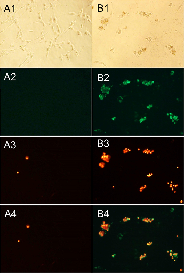 Induction of apoptosis in GSCs. (A1) and (B1) control and treat GSCs cells, respectively (bright field microscopic view). (A2) and (B2) fluorometric view of control and treated GSCs after staining with annexin V. (A3) and (B3) fluorometric view of control and treated GSCs after staining with PI; (A4) representing merged of (A2) and (A3) and (B4) representing merged of (B2) and (B3) respectively. The green color indicates the early and red indicates the late apoptotic cells. The image was captured at 40x magnification and the solid bar indicated 20 µm.
