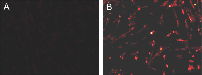 Immunofluorometric assay of the A. racemosus-AgCl-NPs against GSCs. (A) control GSCs and (B) treated GSCs. The image was captured at 40x magnification and the solid bar indicated 20 µm.