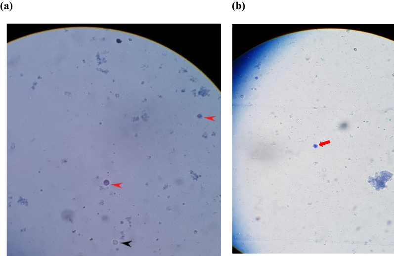 Antiparasitic activity in-vitro.