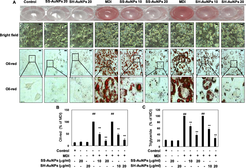 Oil Red-O staining activity and TG accumulation of SS-AuNPs and SH-AuNPs. (A) Oil Red O staining and morphological changes (B) Quantitation of Oil Red O staining activity (Scale bar = 100 μm) and (C) triglyceride content.
