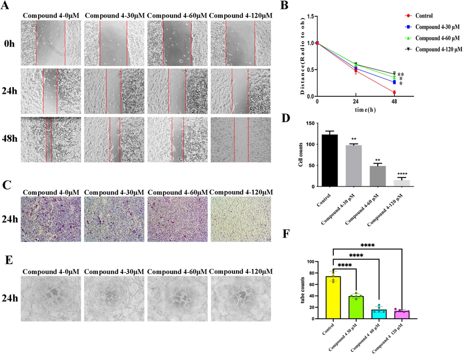 Compound 4 inhibited the migration, invasion and tube formation of HepG2 cells in vitro. (A, B) Compound 4 inhibited the migration of HepG2 cells in a dose-dependent manner. (C, D) The invasion of HepG2 cells was observed at 24 h, and compound 4 had an inhibitory effect on the invasion of HepG2 cells. (E, F) At the end of the 24th hour, compound 4 decreased the number of pipe-like structures in HepG2 cells. (Data was represented as the means ± SD, n = 3. * P < 0.05, ** P < 0.01, *** P < 0.001).