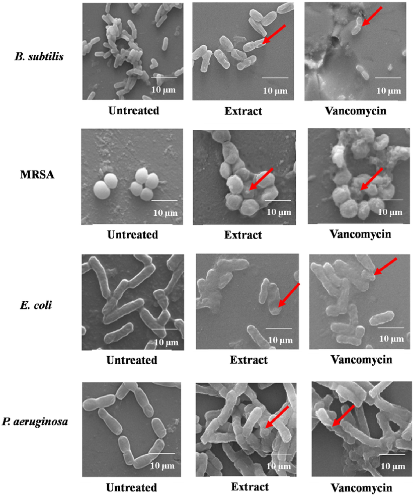 SEM analysis of untreated and treated [methanolic extract (50 µg/mL) and vancomycin (30 µg)] bacterial pathogens. Arrows indicate the destruction of bacterial cell wall due to the inhibitory effects of methanolic extract and vancomycin.