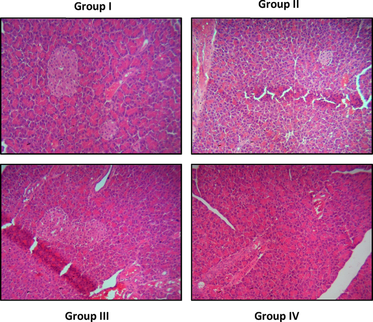 Effect of geraniin on the pancreas histology of the STZ-provoked DR rats. Group I: control animals demonstrated the normal histological appearance. Group II: STZ-challenged DR animals demonstrated the inflammatory signs and pancreatic islets contractions in the pancreas. Group III & IV: The reduced pancreatic lesions and improved islets appearances were noted in the geraniin and metformin treated animals, respectively.