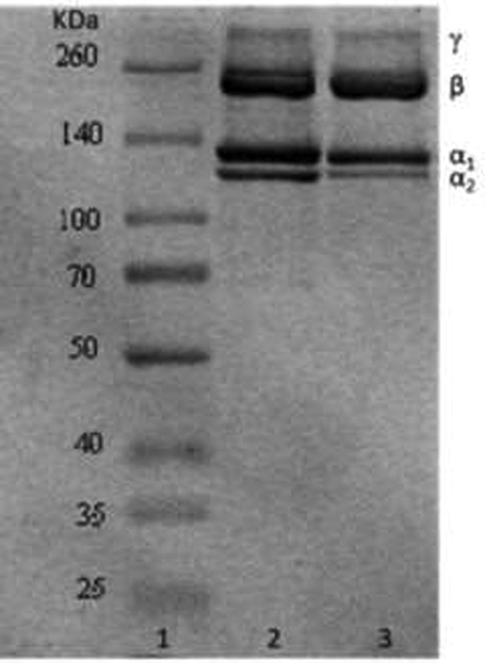 SDS-PAGE pattern. Lanes 1: Marker26634; lane 2: Type Ⅰ rat tail collagen standard; lanes 3: DPC.