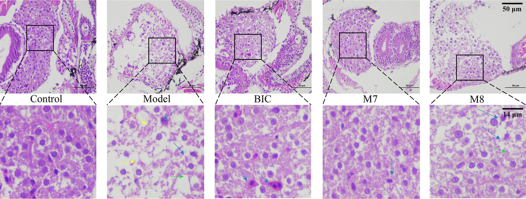 Effects of BIC, M7, and M8 metabolites on zebrafish liver tissue at 72 hpe. Loose cell-to-cell contact is indicated by yellow arrowheads; Macrovacuoles are indicated by green arrowheads; Nuclear atrophy is indicated by blue arrowheads; The first row of photographs was taken under a 400-power microscope and the second row of photographs was magnified 10 times.