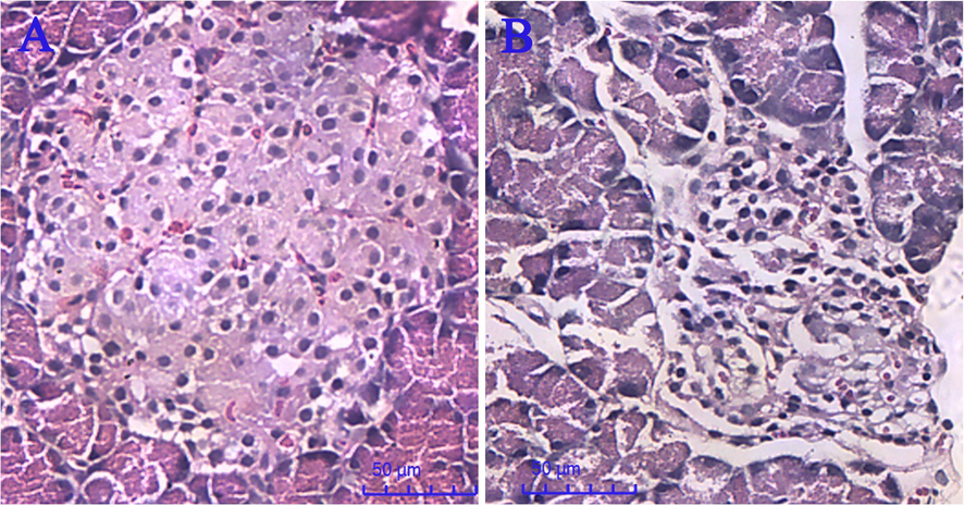 Pancreatic morphology of normal rats (A) and diabetic rats (B).