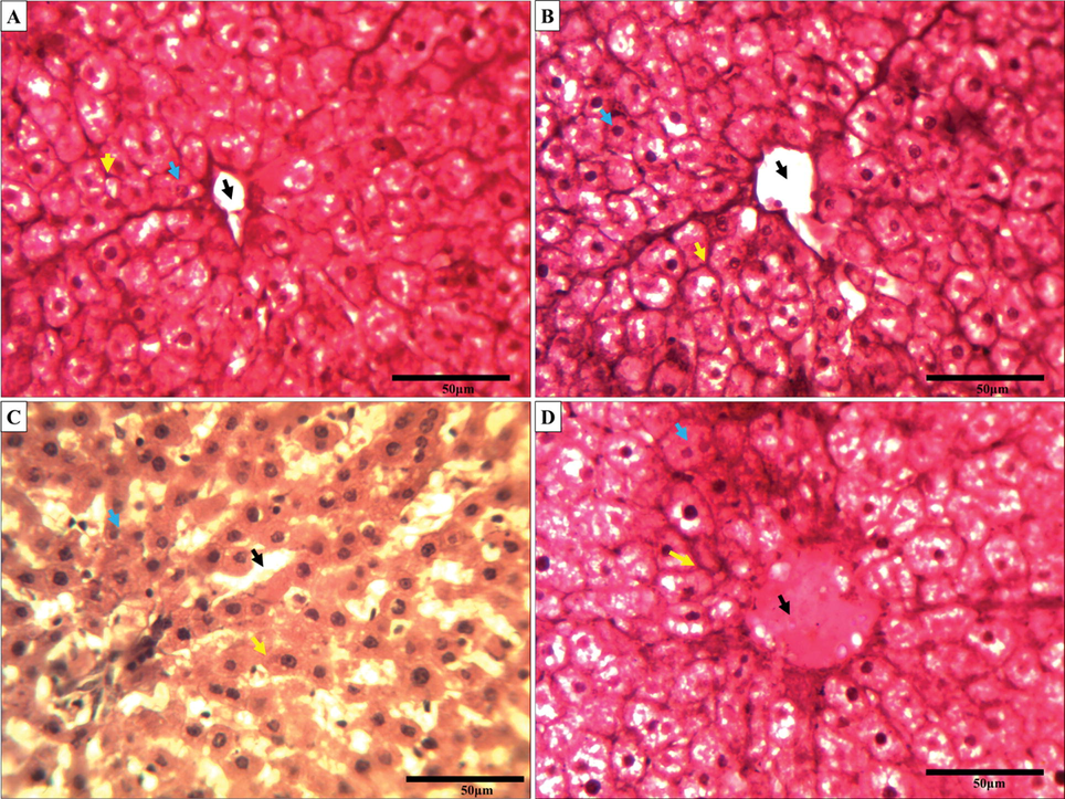 The changes in rat liver tissue section are due to the exposure of malathion and A. vera (H&E staining, ×40). A micrograph of control liver tissue section (A); A. vera treated (B); Cartap treated (C); and A. vera + malathion treated (D) groups. The treatment procedures were the same as indicated in Materials and Methods. The black arrow, yellow arrow and blue arrow indicated the disorganization of central vacuole, hepatic cords, and the normal cellular architecture, respectively, of the rat liver tissue under malathion exposure.