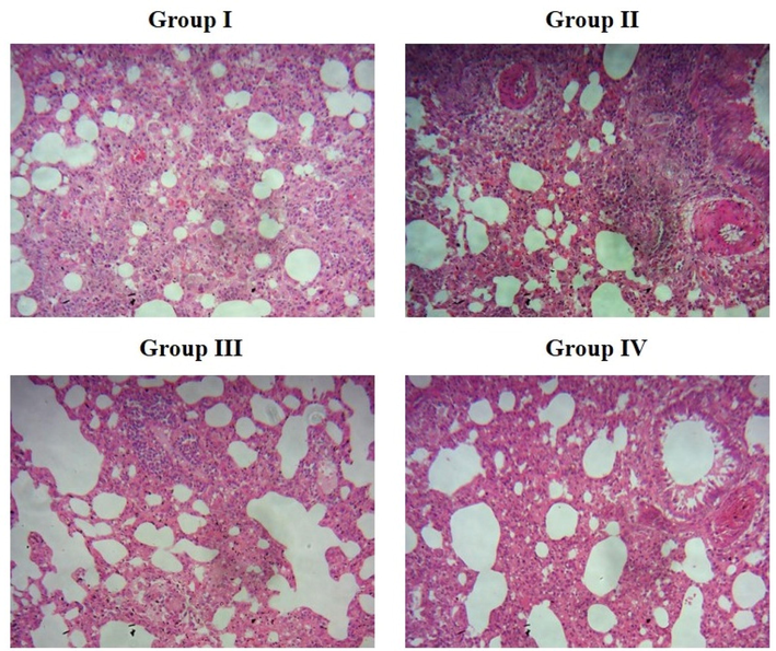 Effect of bakuchiol on the lung histopathology of pneumonia-induced mice. Group I. Alveolar structures in control mice are normal, and there are no symptoms of inflammation or lesions. Group II. Greater inflammatory cell infiltrations, thickening of alveolar walls, and constricted bronchial tubes were observed in the lung tissues of MP-infected pneumonia mice. Group III. Treatment with 25 mg/kg of bakuchiol significantly decreased the histological changes in the lung tissues of pneumonia mice. Group IV. Histological changes in the lungs were substantially suppressed by standard drug azithromycin treatment.