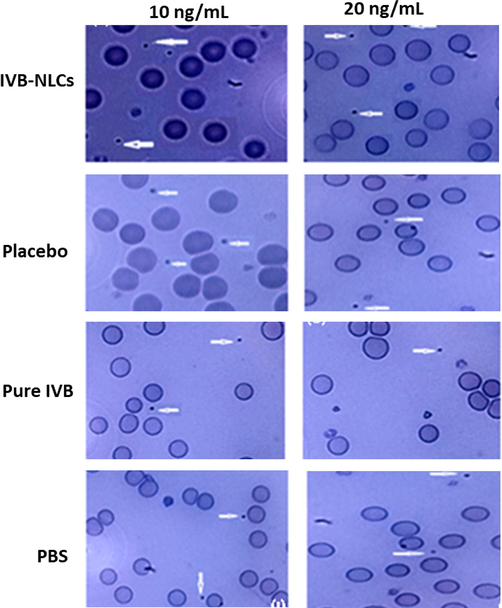 Light microscopy images (100X resolution) of Leishman’s stained whole blood samples after treating with PBS, pure IVB, placebo and IVB-NLCs, in concentration of 10 and 20 ng/mL.