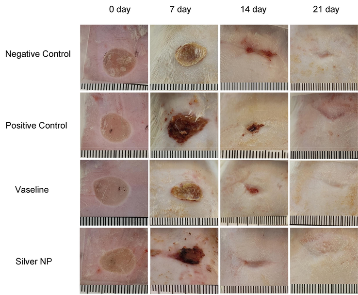 Effect of AgNPs@PCS group (Silver NP), pure Vaseline (Vaseline), silver sulfadiazine (Positive control) and Negative control on the wound closure rate in rats.