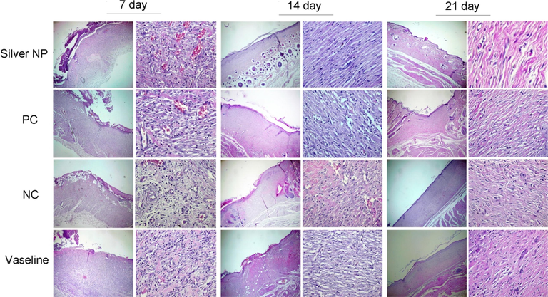 Histopathology of wounds on the 7th, 14th, and 21th days after injury (hematoxylin and eosin, ×40 and × 400).