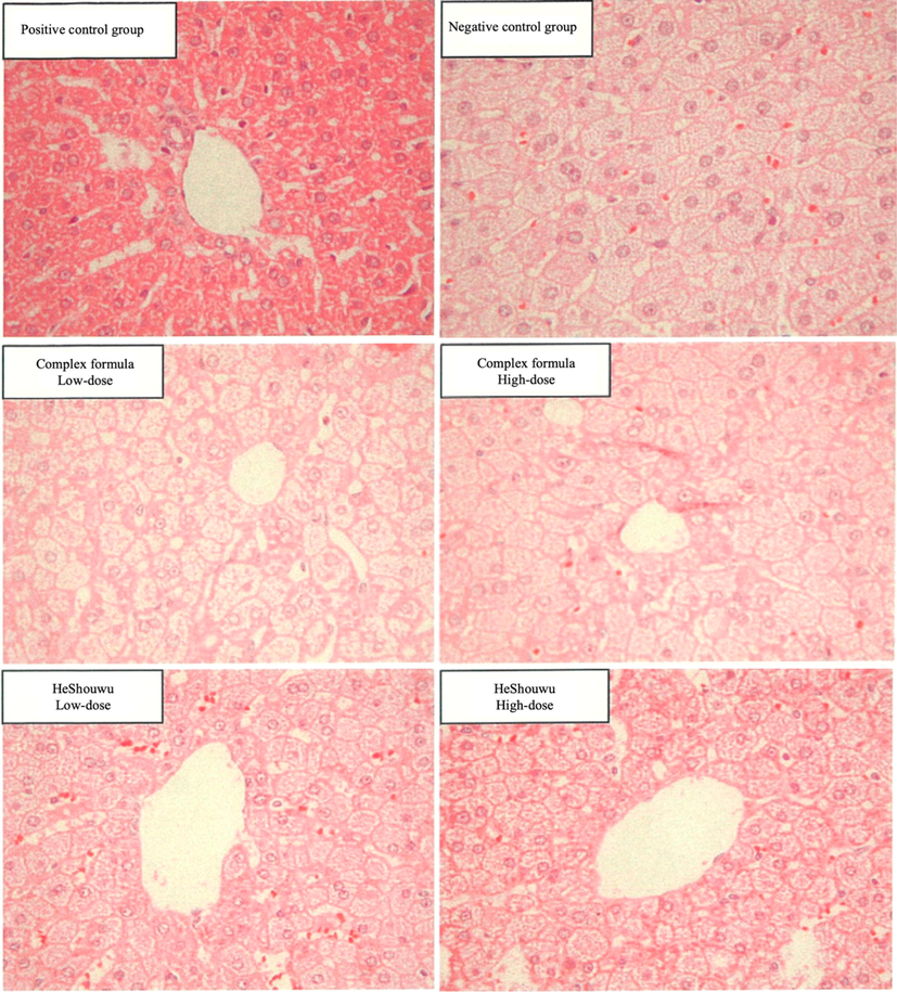 Histopathological section of hamsters fed with HeShouWu (Polygonum mulitiflorum) and its complex formula, positive and negative control groups hamsters' liver (Magnification ratio 400 × ).