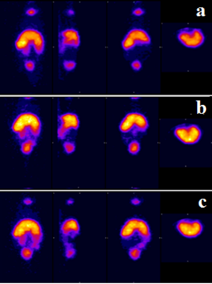 Whole body SPECT imaging of 99mTc-chitosan-glutmine in mice (a) 15 min, (b) 60 min and (c) 120 min.