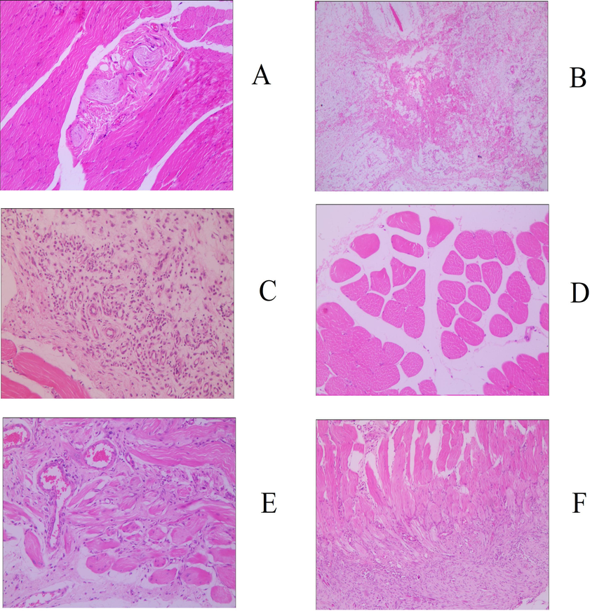 Histology image of skeletal muscle (200x), groups: a. blank, b. serum, c. positive control, d. gyp low dose, e. gyp medium dose, f. gyp high dose.