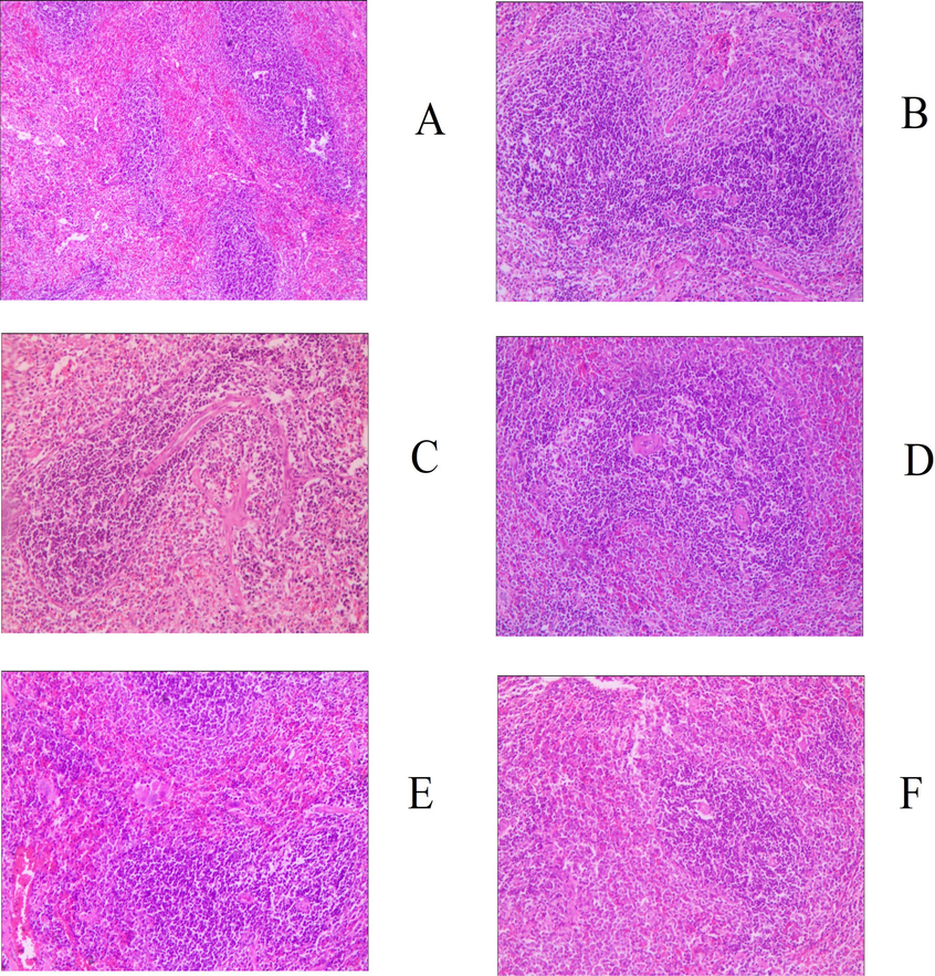 Histology image of spleen (200x), groups: a. blank, b. serum, c. positive control, d. gyp low dose, e. gyp medium dose, f. gyp high dose.