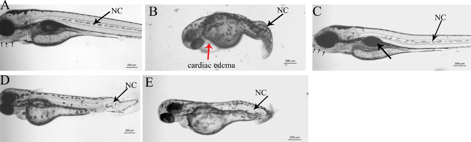 Craniofacial cartilage and notochord defects induced by C. verum extracts in zebrafish larvae. The photomicrograph is the representative image of the live zebrafish larvae snapped at four dpf. A) Control. Small arrows under the mouth indicate the normal development of craniofacial cartilage and the black arrows indicate the notochord (NC). B) Zebrafish embryos treated with 1 µg/ml of chloroform extract. The treated embryos showed severe developmental abrnomalities, smaller as compared to control larvae at the same stage.The posterior trunk did not develop as well. The embryos had severe cardiac edema (red arrow). C) zebrafish embryos treated with 500 µg/ml of methanol extract. The methanol extract did not induce any obvious defects, and the larvae's development and size were the same as control larvae at 4dpf. D) Zebrafish embryos treated with hexane extract. Moreover, craniofacial cartilage was also absent in these embryos. The embryos were smaller size as compared to the control. E). A clear undulation of notochord can easily be visualized in zebrafish embryos treated with ethyl acetate extract. Moreover, the craniofacial cartilage did not form in these larvae. F). All images are taken by keeping the larvae anterior to the left under the same magnification. The scale bar is shown at the right lower side of each image.