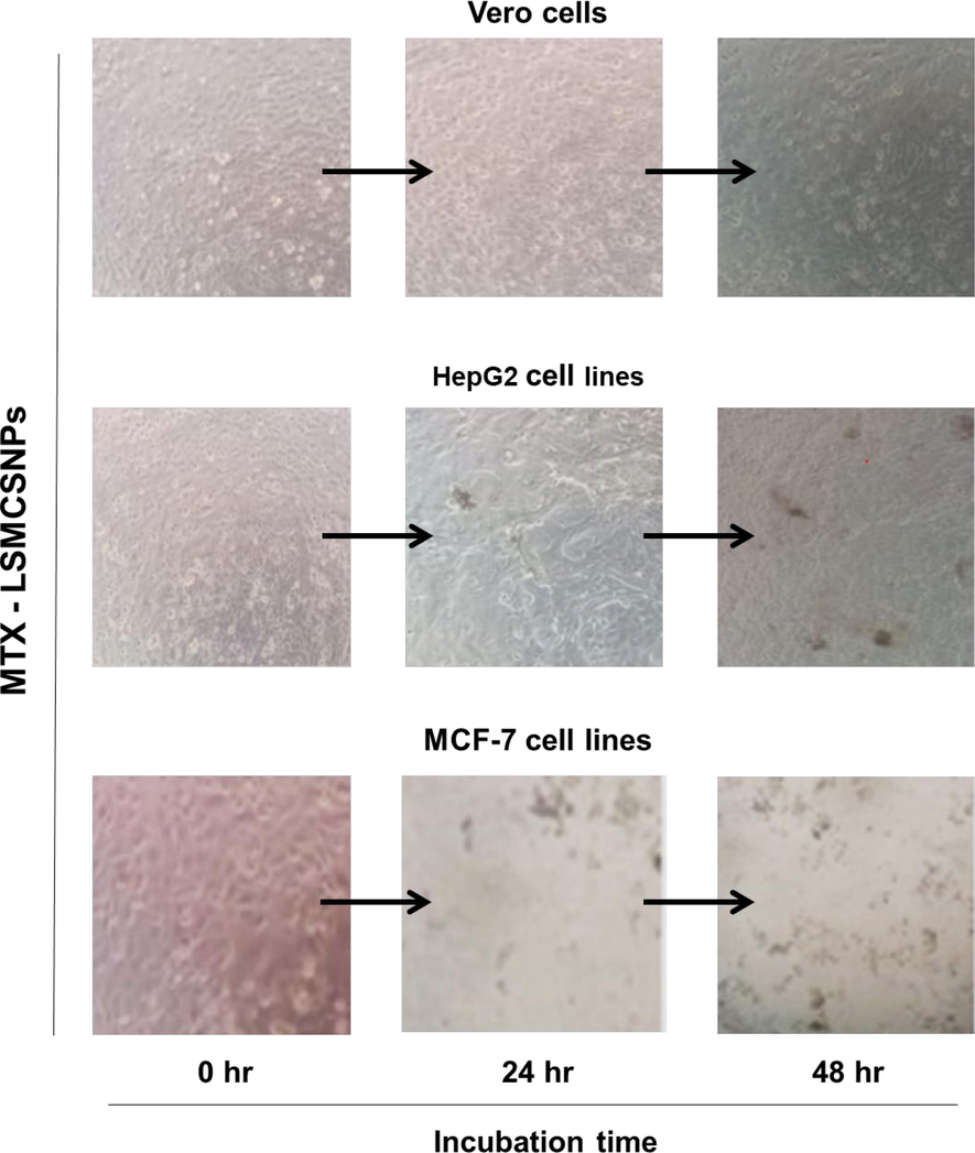 Representative images of Vero (normal cells), HepG2 and MCF-7 cancerous cells upon treatment with F3 formulation (Scale bar = 1 mm).