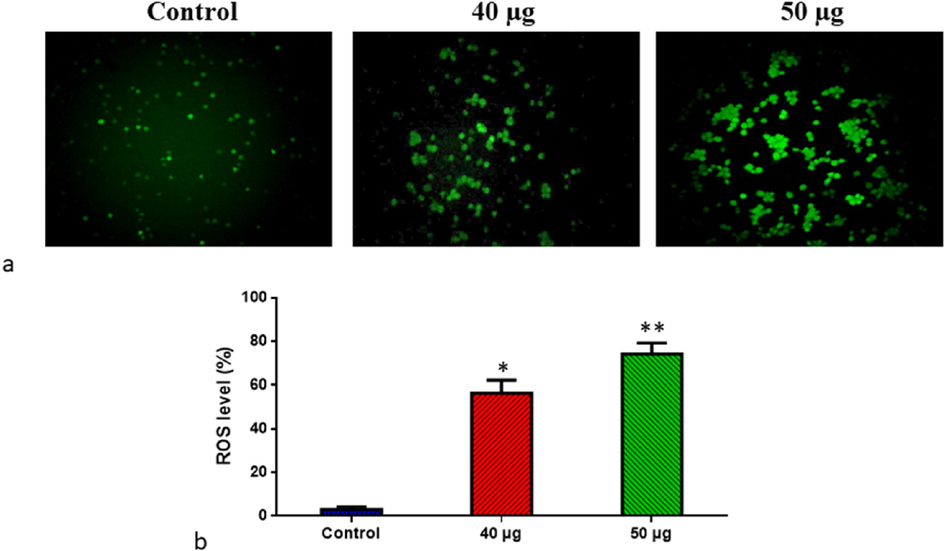 Effect of SnNiCoO2 NPs on the intracellular ROS generation in the blood cancer MOLT-4 cells. The MOLT-4 cell line is subjected to oxidative stress induced by SnNiCoO2 NPs staining with DCFH-DA. Then the digital images were captured by a Fluorescence microscope (Labomed, USA). Control cells showed a dull green fluorescence that indicates poor ROS generation. The SnNiCoO2 NPs (40 and 50 µg/ml) treated cells showed a bright green fluorescence, which confirms the increased ROS production in MOLT-4 cells. (a); Control (untreated cells), SnNiCoO2 NPs-treated cells; 40 µg/ml concentration and 50 µg/ml concentration. (b); ROS levels in percentage from the control and treated cells incubated at 37 °C were measured by a fluorescence microplate reader using the H2DCFDA dye. *p < 0.05 compared to the “Control” group and **p < 0.005 compared to the “Control” group.