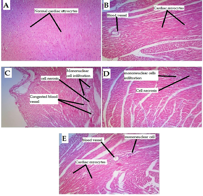 Histopathological changes in rat hearts induced by 5-Florouracil and protective effect of the test compound (A) Rat heart sections from the control group (normal saline) had normal morphology. (B) Heart sections of rats treated with 5-Florouracil + Athenol had normal morphology with no cellular infiltration and normal blood vessels. (C) Heart sections from rats treated with 5-Florouracil alone, showing generalized cardiac edema, perivascular mononuclear cell infiltration, hyaline degeneration, and necrosis. (D) 5-Florouracil + Succ-5 (5 mg/kg I.P) treated group showed degeneration and mononuclear cell infiltration, hyaline degeneration, and a few necrosis (E) 5-Florouracil + Succ-5 (10 mg/kg I.P) treated group against 5-Florouracil induced heart injury. The 5-Florouracil + Succ-5 (10 mg/kg I.P.) treatment group showed significant protection against 5-Florouracil induced cardiac injury as mild mononuclear cell infiltration was observed in and around normal blood vessels (Increased, 10 × ).