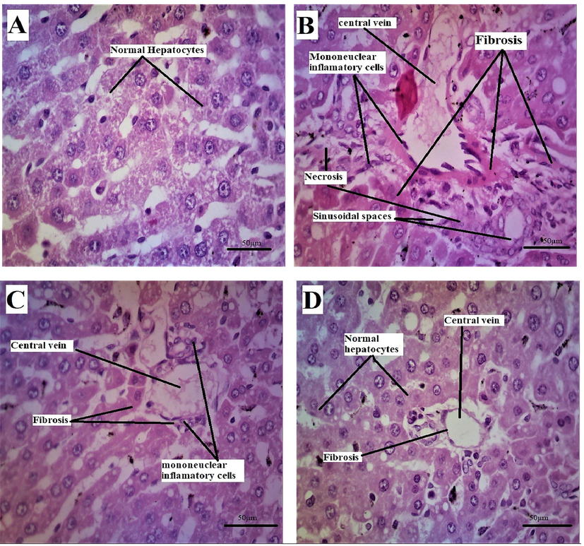 Rat liver (A) of the normal group showing the normal histological structure of the hepatic lobe with normal central vein (CV) and normal hepatocytes. (B) 5-Florouracil treated group showing centrilobular hepatocellular necrosis associated with hemorrhage and mononuclear inflammatory cell infiltration and fibrosis. (C) Group treated with 5-Florouracil + Succ-5 5 mg/kg I.P showing hepatocyte degeneration, mononuclear inflammatory cell infiltration and fibrosis with congested central vein. (D) Group treated with the formula 5-Florouracil + Succ-5 10 mg/kg I.P, showing hepatocyte regeneration and mild fibrosis (Enlargement, 40 × ).