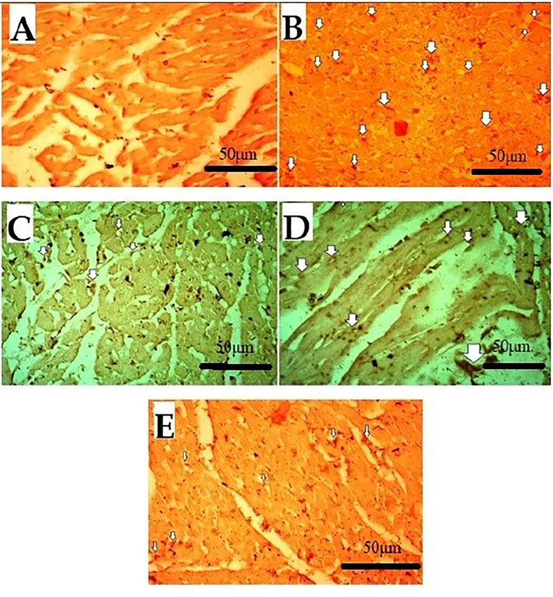 Effect of Succ-5 (at 5 mg/kg, 10 mg/kg doses) and Atenolol against immune-histochemical expression of cyclooxygenase-2 (COX-2) in 5-FU induced toxicity rats' heart tissue, using immunohistochemistry technique. A. saline group, B. 5-FU treated group, C. Atenolol treated group, D. Succ-5 at 5 mg/kg dose treated group, E.Succ-5 at 10 mg/kg dose treated group. White arrows indicate the expression of immune marker on cardiac cells. (Enlargement, 40 × ).