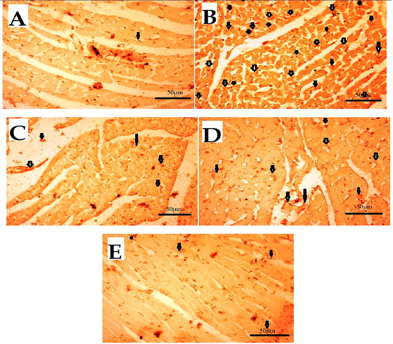 Effect of Succ-5 (at 5 mg/kg, 10 mg/kg doses) and Atenolol against immune-histochemical expression of tumour necrosis factor alpha (TNF-α) in 5-FU induced toxicity in rats' heart tissue, using immunohistochemistry technique. A. Saline group, B. 5-FU treated group, C. Atenolol treated group, D. Succ-5 (at 5 mg/kg dose) treated group, E.Succ-5 (at 10 mg/kg dose) treated group. Black arrows indicate the expression of immune marker on cardiac cells. (Enlargement, 40 × ).