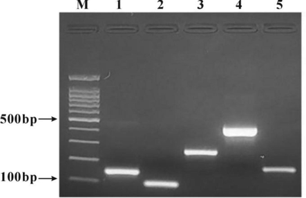 Electrophoresis of five positive control PCR products. M: 100 bp DNA ladder; 1: Cow; 2: Sheep; 3: Pig; 4: Horse; 5: Deer.