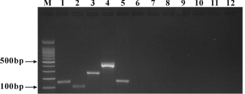 Specificity test of the self-developed multiplex PCR detection kit. M: 100 bp DNA ladder; 1: Beef DNA; 2: Mutton DNA; 3: Pork DNA; 4: Horse DNA; 5: Venison DNA; 6: Chicken DNA; 7: Duck DNA; 8: Donkey DNA; 9: Rat DNA; 10: Mink DNA; 11: Dog DNA; 12 Blank control.