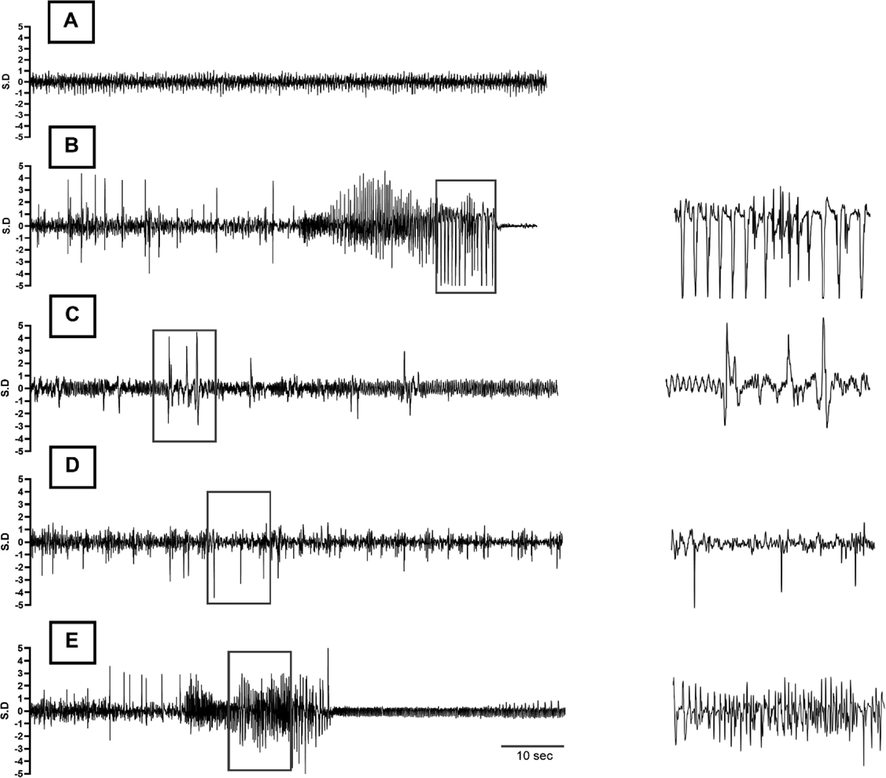 Typical EEG traces recorded during the experiment. (A) Representative portion of baseline EEG before administration of the chemo-convulsant. (B-E) 90 s of electrical activity recorded after appearance of first epileptic spike post-PTZ injection, showing EEG of (B) PTZ control (PTZ only), (C) Standard Control (Diazepam + PTZ), (D) Treatment group 1 (Compound 7b + PTZ) and (E) Treatment group 2 (Compound 7c + PTZ), respectively. A high timed resolution of spike cluster(s) (square boxes) is shown in parallel to the corresponding EEG tracings as well.