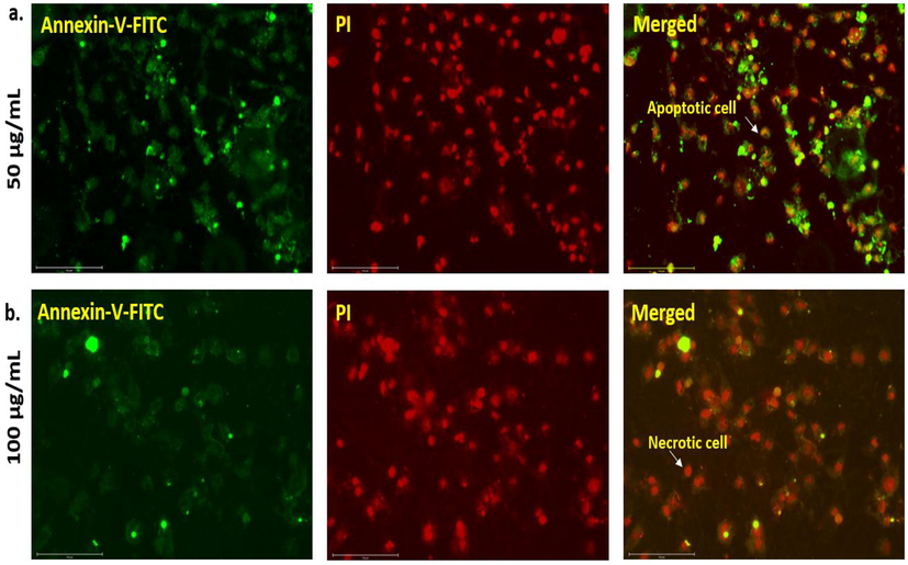 A549 cells induced with (a) 50 µg/ml and (b) 100 µg/ml of NS-IONPs for 48 h and stained with the Annexin V-FITC Apoptosis detection kit. The cells in apoptotic/necrotic state were detected.