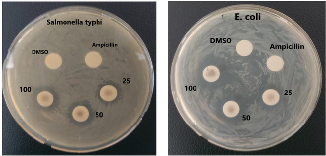 Antibacterial activity of NS-IONPs.