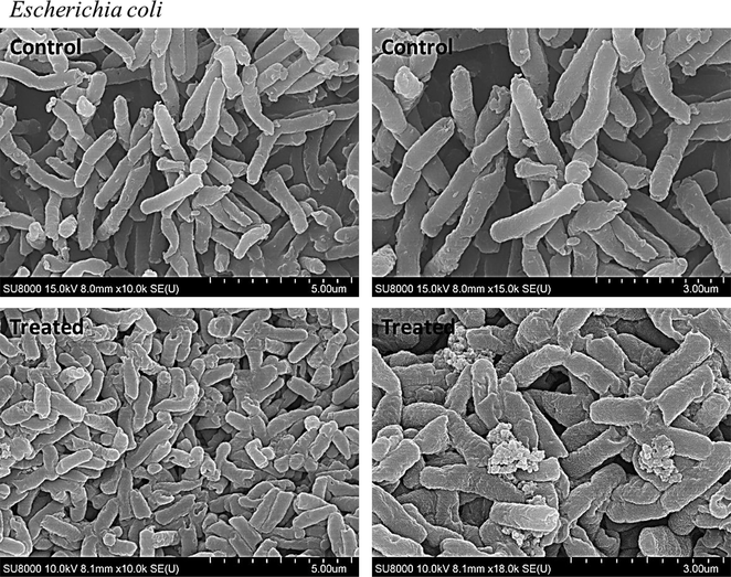 Scanning electron microscopy images of E. coli - control (before treatment) and treated (after treatment with NS-IONPs).