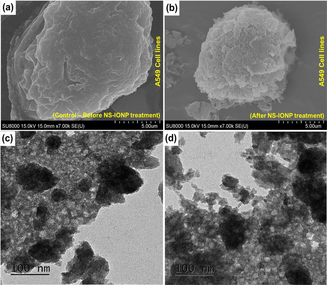 Scanning electron microscope images of the A549 cells – (a) Control – before treatment, (b) cells after treatment with NS-IONPs; transmission electron microscope images of the A549 cell lines (c) cell uptake of NS-IONPs, some particles were slightly aggregated as they were absorbed into the cell, (d) cells undergoing lysis after 48 h of NS-IONP treatment.