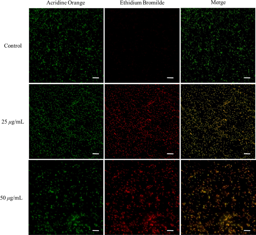 AO/EB dual fluorescence staining results for Xoo after incubation with D3 for 12 h. All the scale bars for are 10 μm.