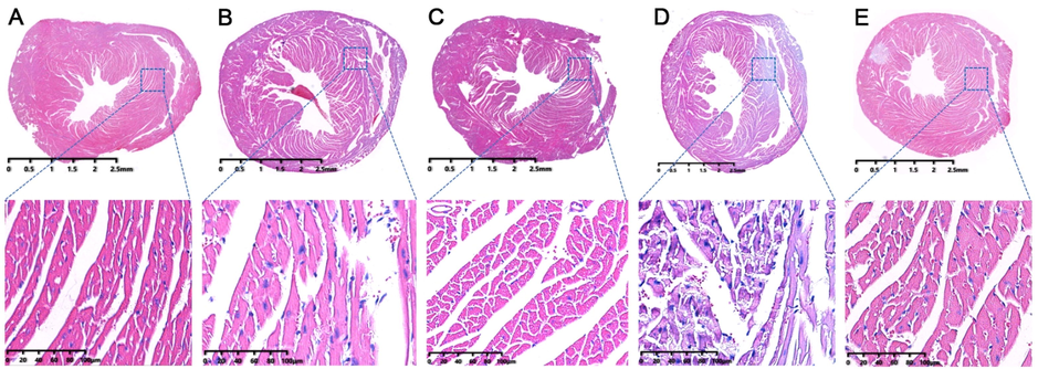 The HE staining results of mice heart tissues. (A) control group; (B) model group; (C) RSV group; (D) AMB extracts group; (E) ACGD extracts group. The scales were 2.5 mm and 100 μM (magnification, 25×).