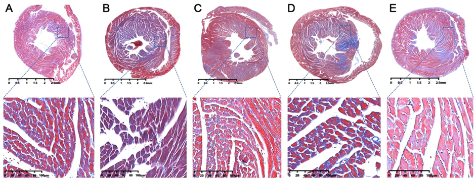 The Masson staining results of heart tissues in mice. (A) control group; (B) model group; (C) RSV group; (D) AMB extracts group; (E) ACGD extracts group. The scales were 2.5 mm and 100 μM (magnification, 25×).