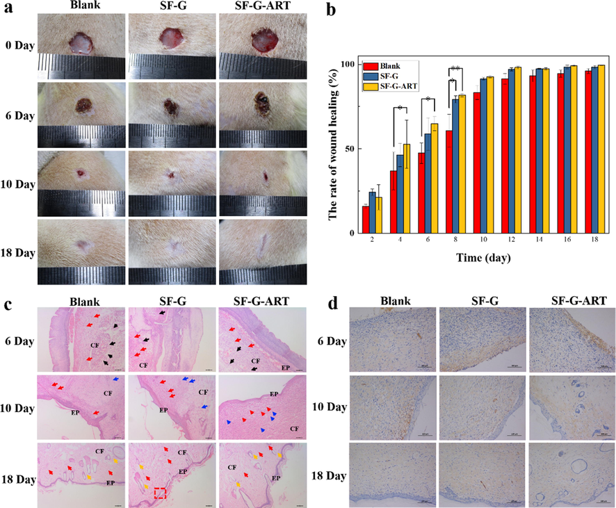 The effect of fabricated hydrogels on wound healing. (a) Photographs of wounds treated with different hydrogels. (b) Area ratio of wound healing. (c) H&E histological analysis of wounded rats skin on days 6, 10, and 18. Red arrows indicate fibroblasts, black arrows indicate inflammatory cells, blue scissors indicate capillaries, orange arrows indicate hair follicle structure, CF represents collagen fibers and EP represents epidermis. (d) EGF immunohistochemical analysis of rat wounded skin on days 6, 10 and 18. Data are expressed as mean ± standard deviation of triplicate sample.