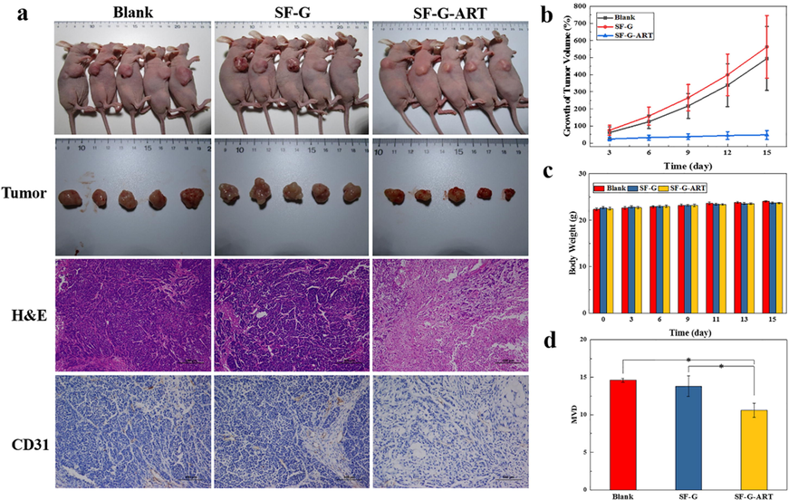 Tumor therapy of fabricated hydrogels. (a) Tumor photos, H&E staining and CD31 IHC staining after 15 days of treatment with different hydrogels. (b) Growth rate of tumor volume. (c) Changes in body weight of nude mice. (d) Tumor microvessel density after 15 days of treatment with different hydrogels. Data are expressed as mean ± standard deviation (n = 5).