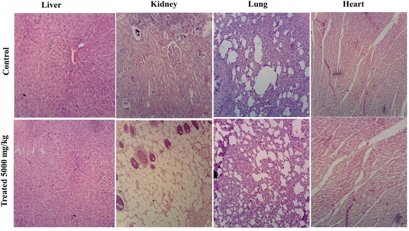 Micrographs of histopathological examination of vital organs of treated and control rats in oral toxicity evaluation of PAME.