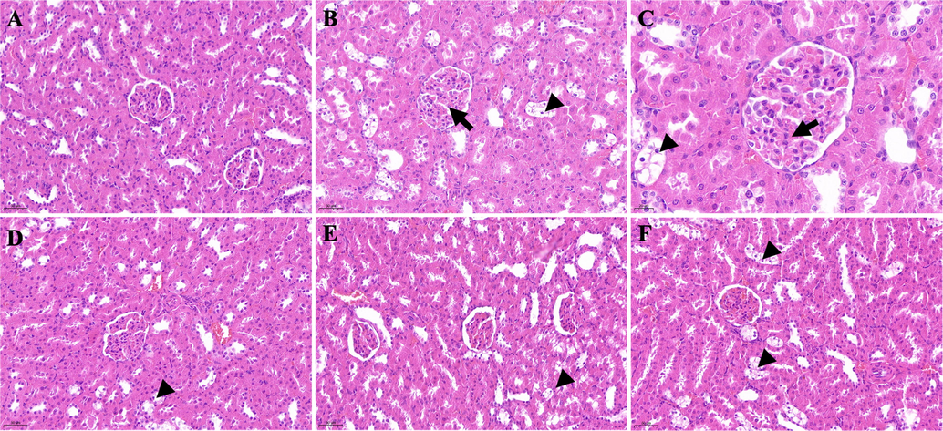 Histological examination of kidney sections in different groups. A: Control group (200 × magnification); B: DM group (200 × magnification); C: DM group (400 × magnification); D: DM + GLB group (200 × magnification); E: DM + PD150 group (200 × magnification); F: DM + PD300 group (200 × magnification). PD: Plagiorhegma dubia; DM: Diabetes mellitus; GLB: Glibenclamide.