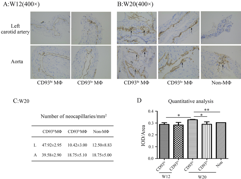 Evaluation of CD93 hi macrophage on atherosclerosis through dynamic ...