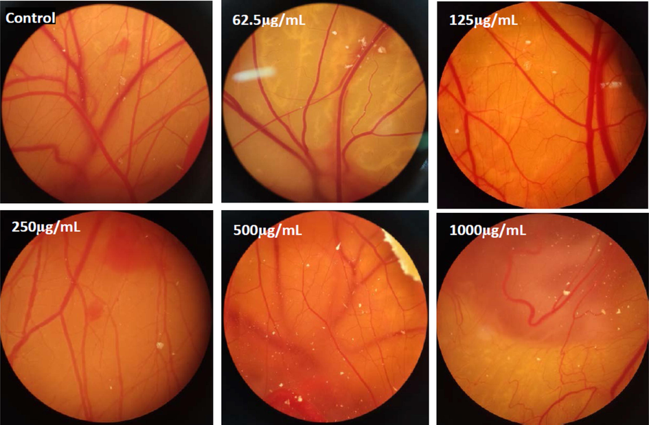 Decline of angiogenesis in the samples that were exposed to various doses of Se-Au-CS compared with the control group.