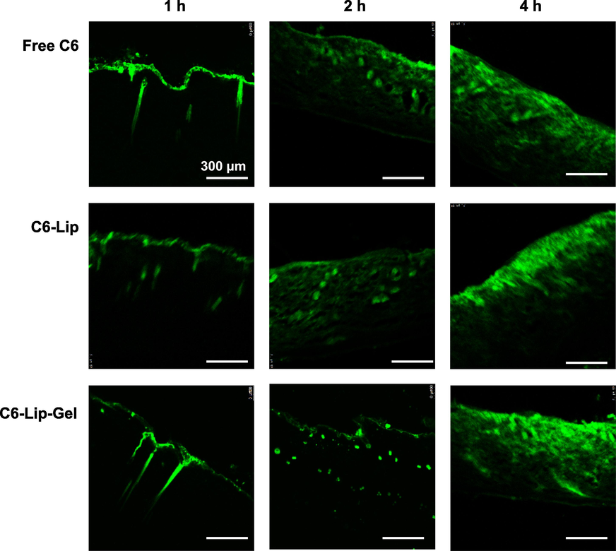 Fluorescence observation of C6, C6-Lip and C6-Lip-Gel in vitro transdermal sections.