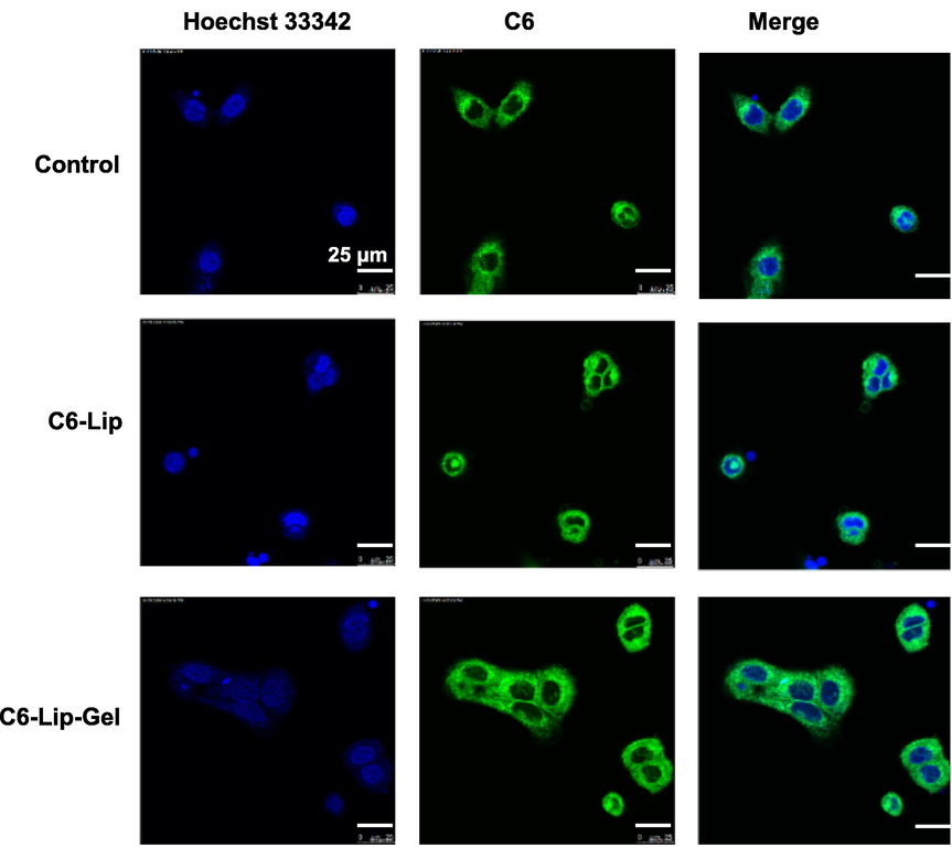 Laser confocal micrographs of HaCaT cell uptake of C6-labelled Lip and Lip-Gel.