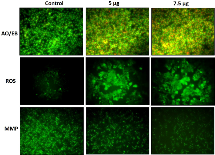 NOZ cells are apoptotic when treated with ZAP-Bru nanocomposites. NOZ cell lines of human GBC cell lines were treated with ZAP-Bru nanocomposites for 24 h. Acridine orange and ethidium bromide (1:1), was used to stain the cells. The NOZ cell line is subjected to oxidative stress induced by ZAP-Bru nanocomposites were staining with DCFH-DA. NOZ cells with ZAP-Bru nanocomposites present have a decreased mitochondrial membrane permeability. Rhodamine 123 was used to stain the cells.