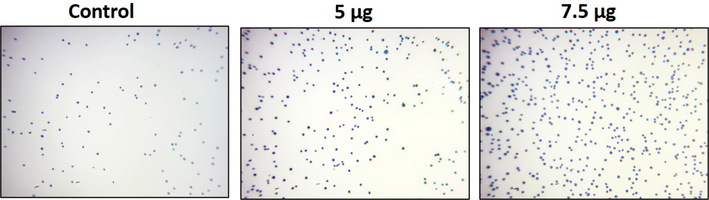 Cell adhesion is impaired by ZAP-Bru nanocomposites in NOZ cells. ZAP-Bru nanocomposites and doxorubicin were used to treat human GBC cell line NOZ cell lines. In the following figures, representative stained cells of the control and treated groups were shown in cell adhesion assays. Control, ZAP-Bru nanocomposites-treated cells; 5 µg concentration and 7.5 µg concentration.