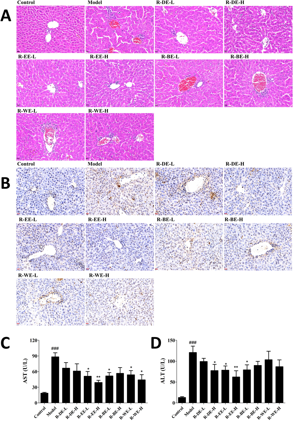 Protective effect of R. simsii Planch extracts on ConA-induced AIH in mice. (A) Liver pathological changes examined by HE (magnification 40 × ), (B) Apoptosis of liver by TUNEL staining (magnification 40 × ), (C and D) Serum AST and ALT levels. L and H indicate the gavage doses of 25 and 50 mg/kg, respectively. Data (n = 6) are expressed as the mean ± SEM. ###p < 0.001, compared with normal; *p < 0.05,** p < 0.01, comparing with model.