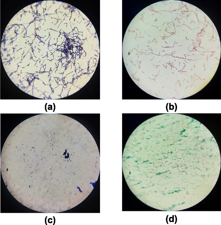 Microscopic images of B. subtilis (a) Gram staining after through SiG filter, (b) spore staining after through SiG filter, (c) Gram staining after through ZnOnano-synth-[chi-SiG] filter, and (d) spore staining after through ZnOnano-synth-[chi-SiG] filter with 1000 × magnification.