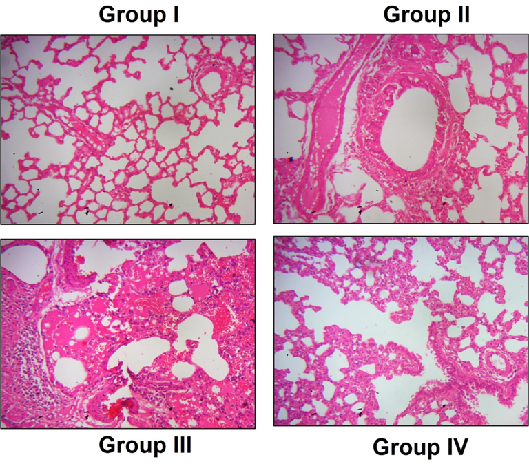 Nigericin protected lung tissue histomorphology of LPS challenged mice. A) Control, B) LPS alone challenged C) LPS + 10 mg/kg nigericin treated, D) LPS + 20 mg/kg nigericin treated. Intact lung histoarchitecture without the evidence of fibrosis, edema was observed in Control group. Thickened alveolar septa with increased neutrophils infiltration in LPS alone challenged mice. Nigericin treated mice shown reduced fibrosis and neutrophil infiltration with decrease in alveolar thickness. Magnification: 40×.